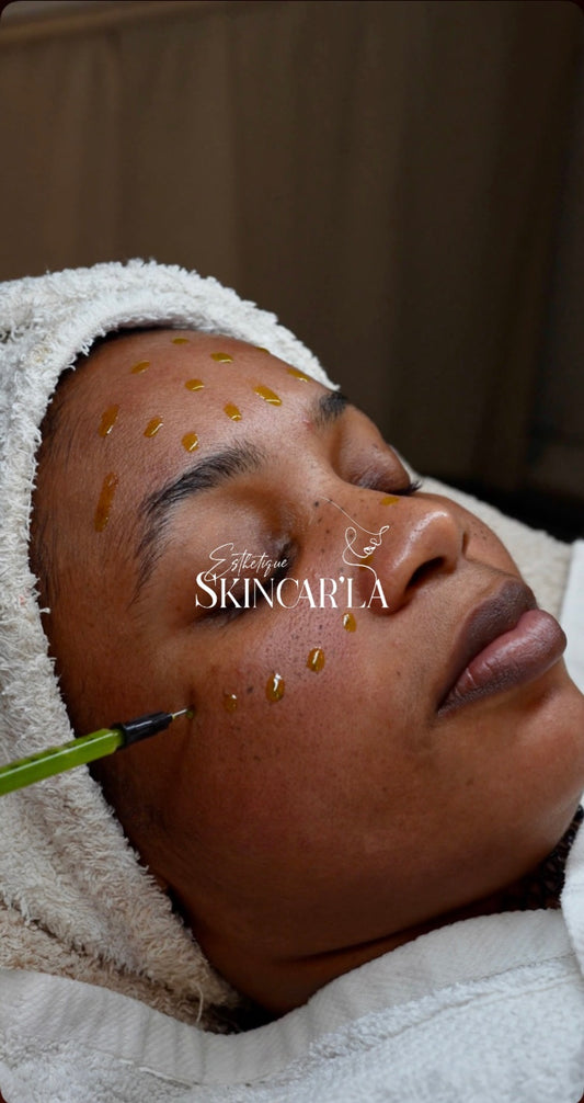 Peeling Biorepeel